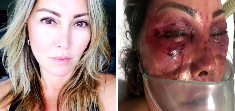 Elaine Perez Caparroz antes e depois das agressões â?? Foto: Reprodução/TV Globo
