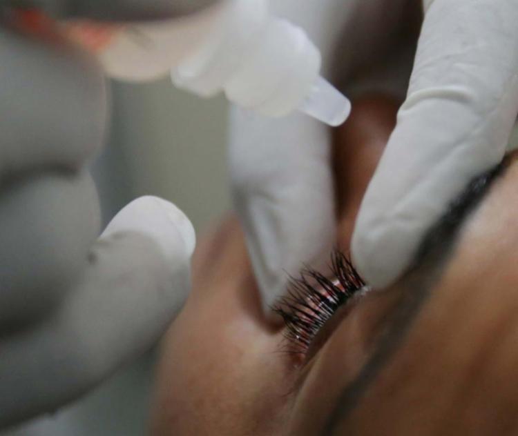 Uso de colírio é uma das indicações de tratamento da doença - Foto: Adilton Venegeroles | Ag. A TARDE