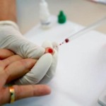 Sesab nega surto de HIV entre jovens na Bahia