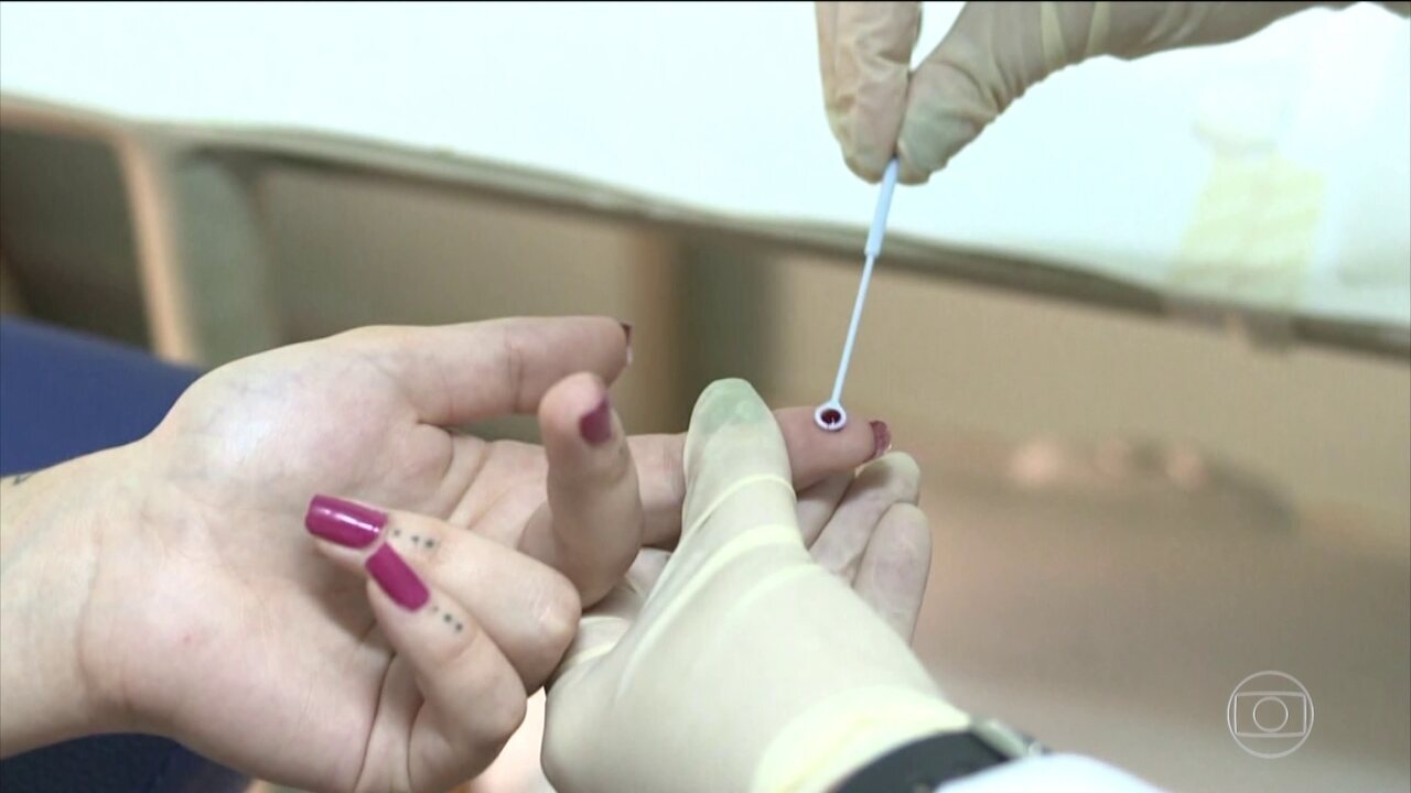 Brasil está na contramão da tendência de queda da Aids no mundo Brasil está na contramão da tendência de queda da Aids no mundo