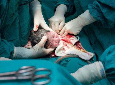 Projeto que permite cesárea por escolha da gestante promete debate acirrado na AL-BA