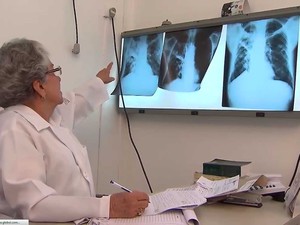 Tuberculose é uma inflamação no pulmão, provocada por uma bactéria (Foto: Imagem/TV Bahia)