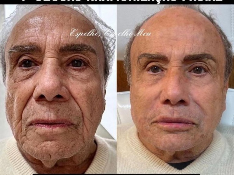 Reprodução/Redes sociais