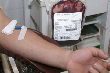 sangue