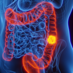 Foto: Divulgação / Sociedade Brasileira de Oncologia