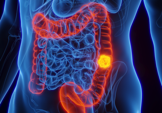 Foto: Divulgação / Sociedade Brasileira de Oncologia