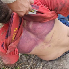 Foto: Reprodu&ccedil;&atilde;o